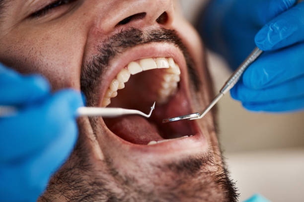 Best Tooth Extraction  in South Henderson, NC